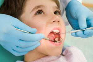 pediatric dentist san antonio